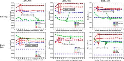 Exploring Optimality of Piecewise Polynomial Interpolation Functions for Lung Field Modeling in 2D Chest X-Ray Images